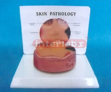 DESK- TYPE COMMON PATHOLOGIES MODEL OF SKIN WITH DESCRIPTION PLATE